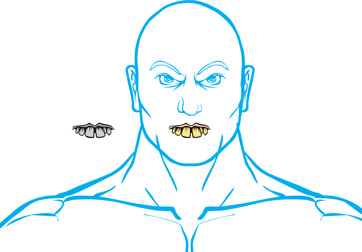 Mouth_BadTeeth.jpg